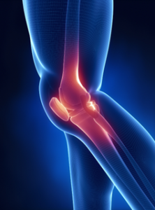 Knee Pain in Overland Park and Reasons for Treatment at Vitality Healing Centers Any kind of joint pain is annoying, but chronic joint pain in Overland Park can be extremely debilitating. The simplest tasks can seem nearly impossible when one has chronic knee pain. Even simple tasks like sitting down or walking can be excruciating due to persistent knee pain in Overland Park, which can worsen if left untreated. 