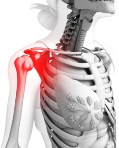 shoulder pain in Leawood